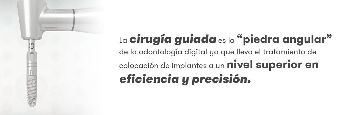 Cirurgia guiada e odontologia digital