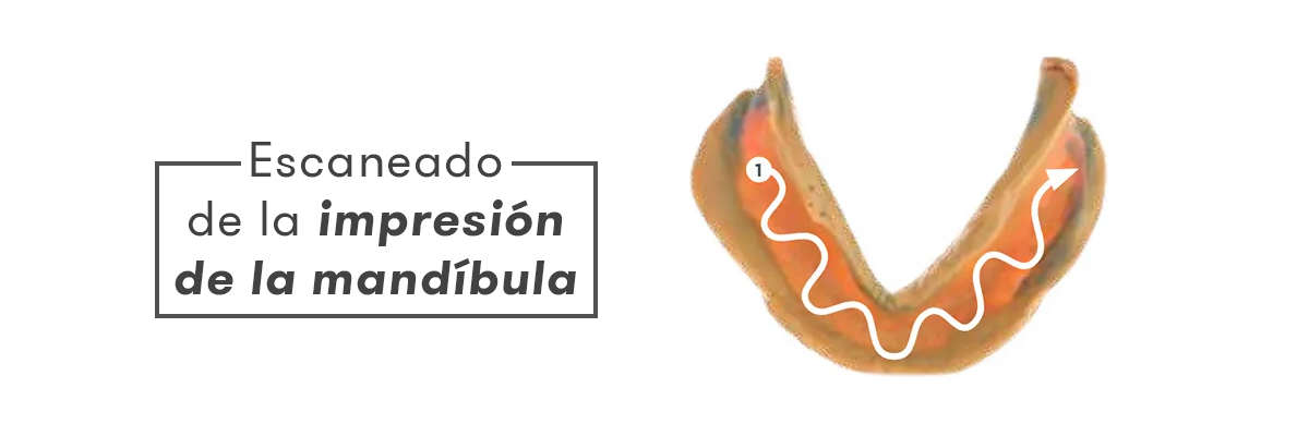 Impresión de la mandíbula