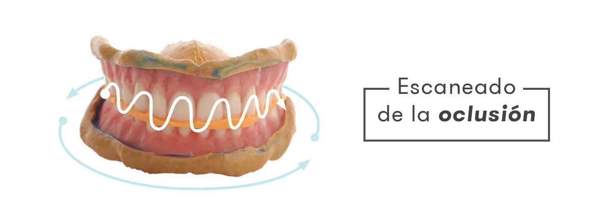 Escaneo de la oclusión