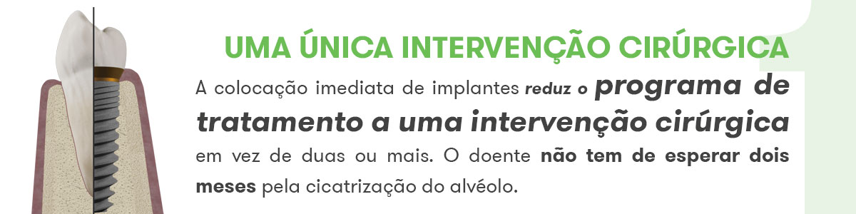 Carga Inmediata em uma intervenção com implantes