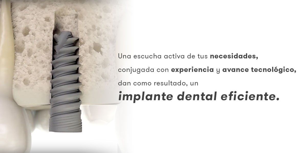 Implantes dentários eficazes graças a um design adaptado às necessidades do dentista.