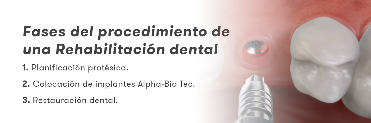 Fases do procedimento de reabilitação dentária 