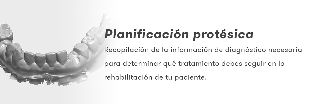 Planeamento protético na colocação de implantes.