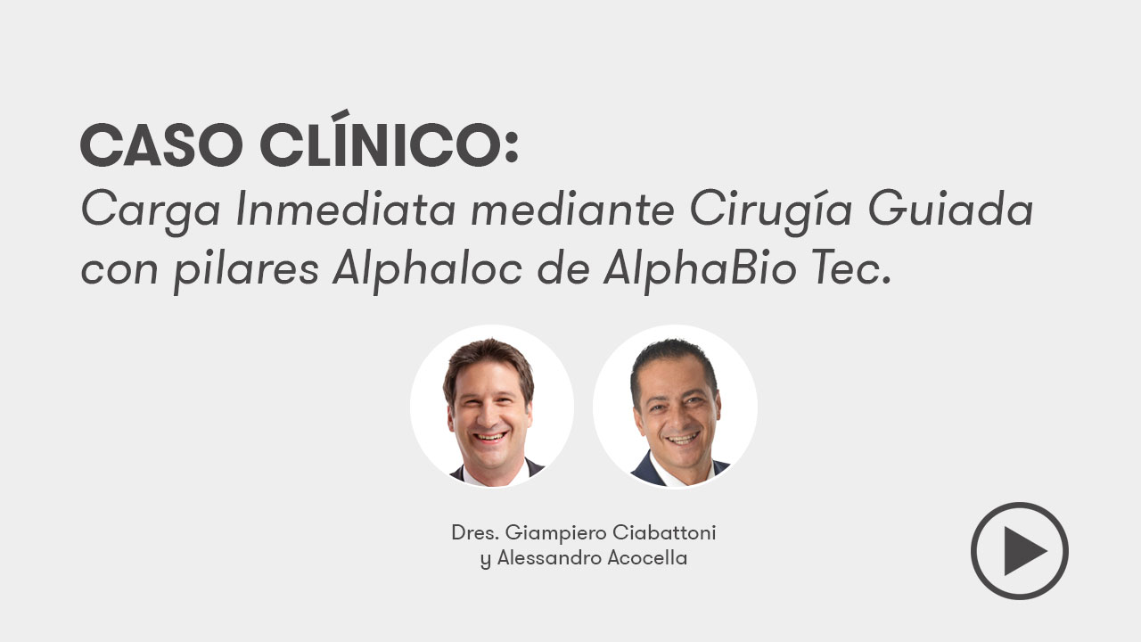 Vídeo caso clínico sobre carga inmediata mediante cirugía guiada con pilares AlphaLoc