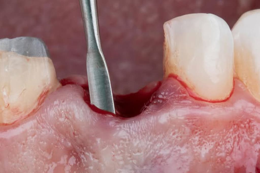 Formación Clínica con el Dr. Alberto Salgado Implantes en zona estética y procedimientos de aumento óseo imagen 2