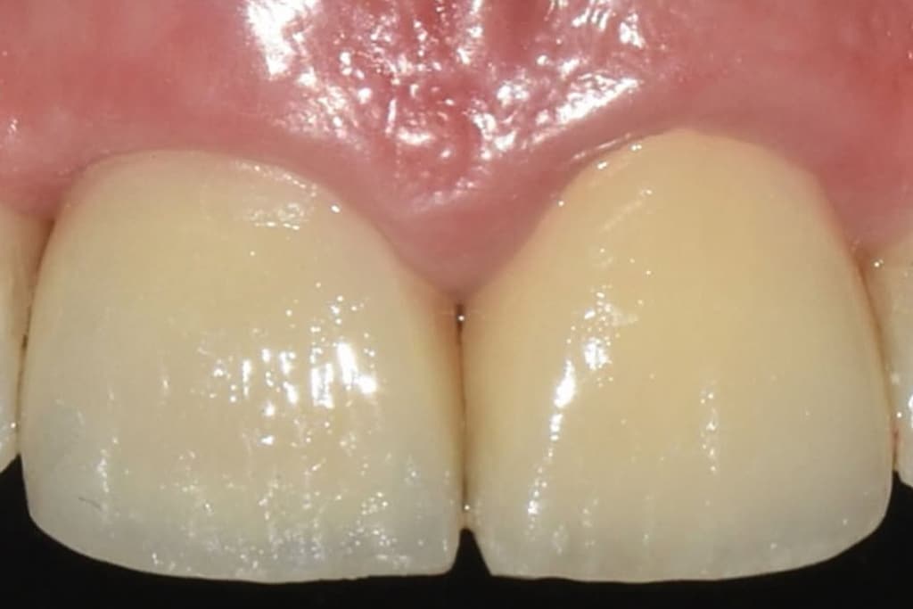 Formación Clínica con el Dr. Alberto Salgado Implantes en zona estética y procedimientos de aumento óseo imagen 3