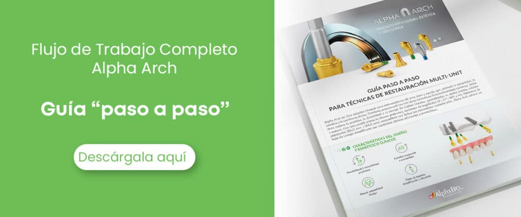 Descarga la guía paso a paso Alpha Arch Blog