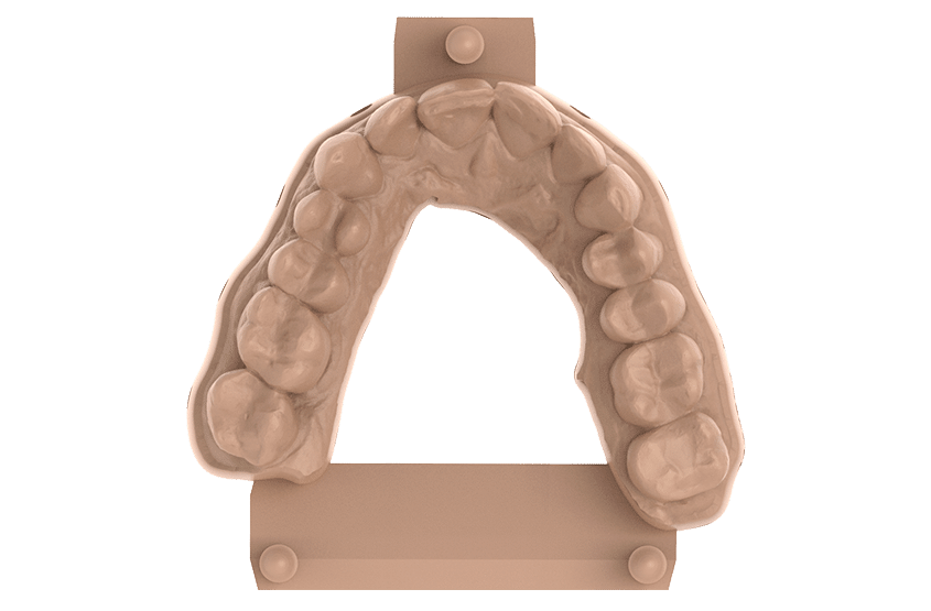 Modelos dentales resina sprintray Die and model