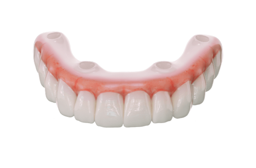 Prótesis híbridas resina sprintray ONX Tough 2