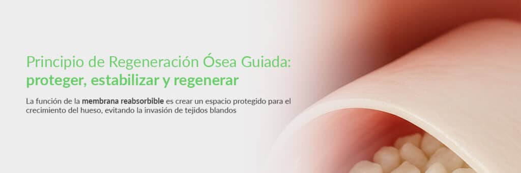 Regeneración ósea guiada con membrana reabsorbible