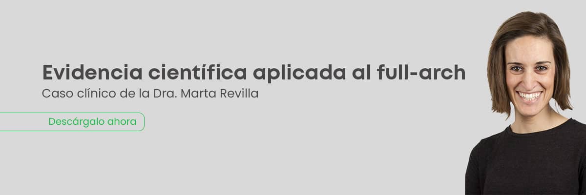 Evidencia científica aplicada al full-arch estudio científico de la Dra. Marta Revilla