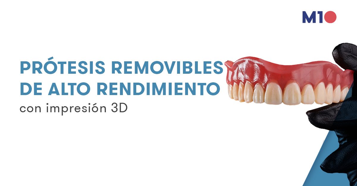 Prótesis removibles de alto rendimiento con impresión 3D