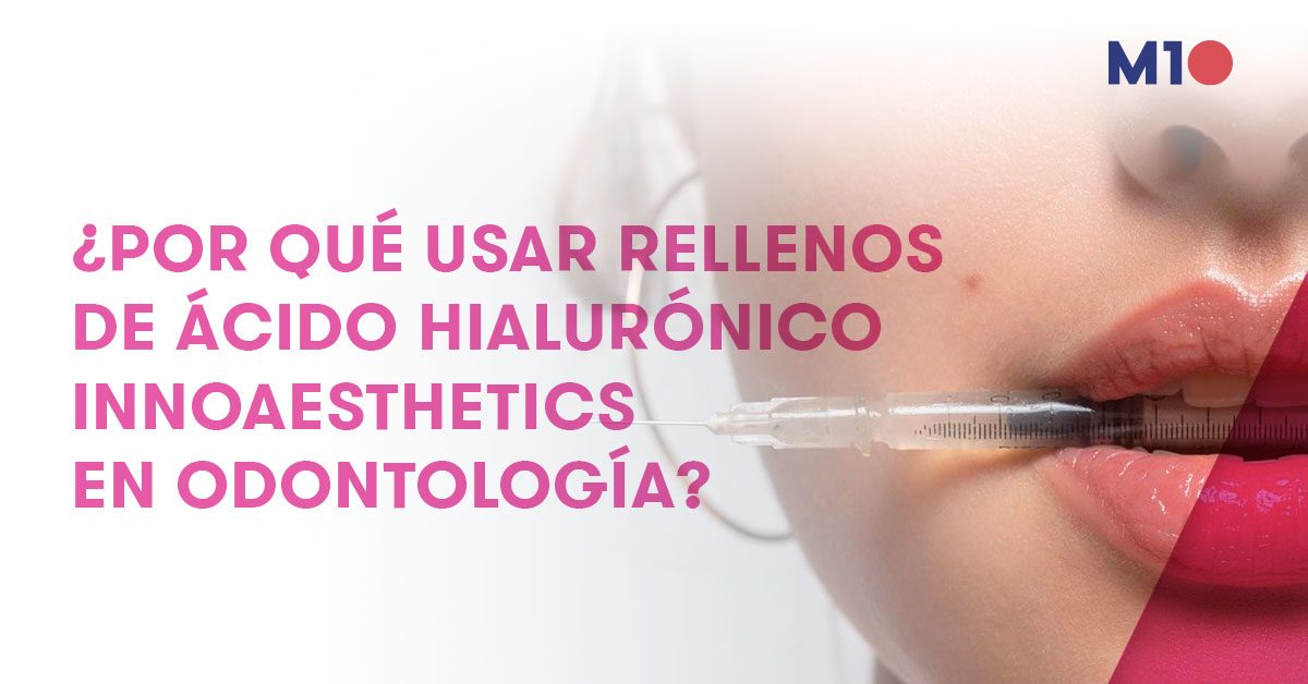 rellenos-de-acido-hialuronico-en-odontologia