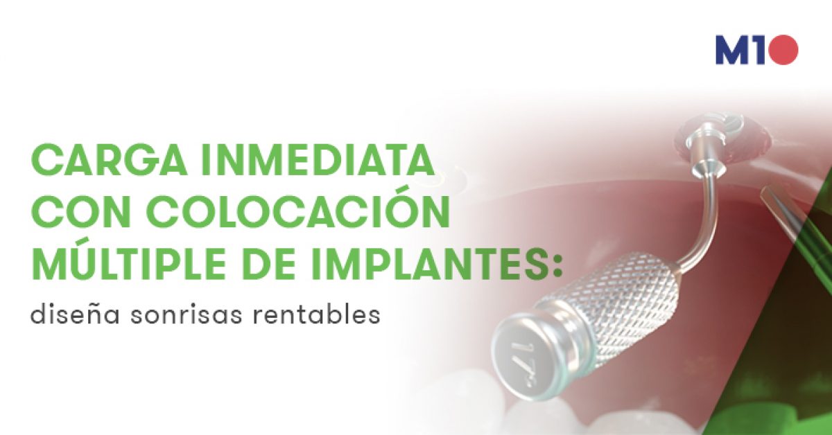 Carga inmediata con colocación de implantes