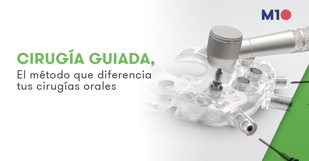 cirugia-guiada-en-odontologia